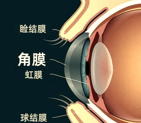 角膜曲率是什么